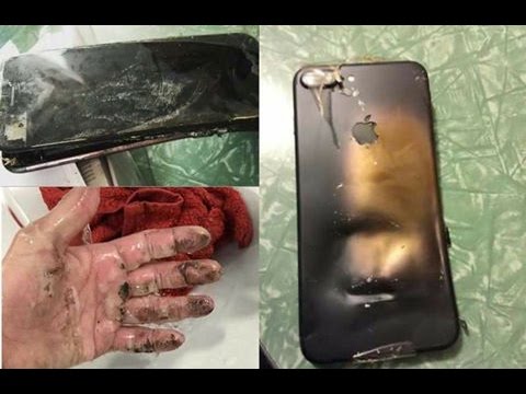 Pin iPhone phát nổ ở Thụy Sĩ, một người bị bỏng